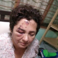 Patricia González fue golpeada por policías estatales cuando se negó a bajar de su auto en un retén. Foto: Cortesía