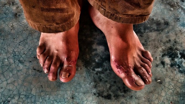 Pausas en el camino en medio de la tragedia. Marco Antonio proveniente de Comayagua, Honduras camino por mas de 18 de la frontera con México hasta Tenosique, esta día descansa en el albergue "La 72" haciendo una pausa en su camino. Foto: Rubén Figueroa